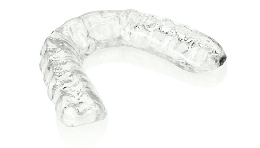 Traditional Retainers